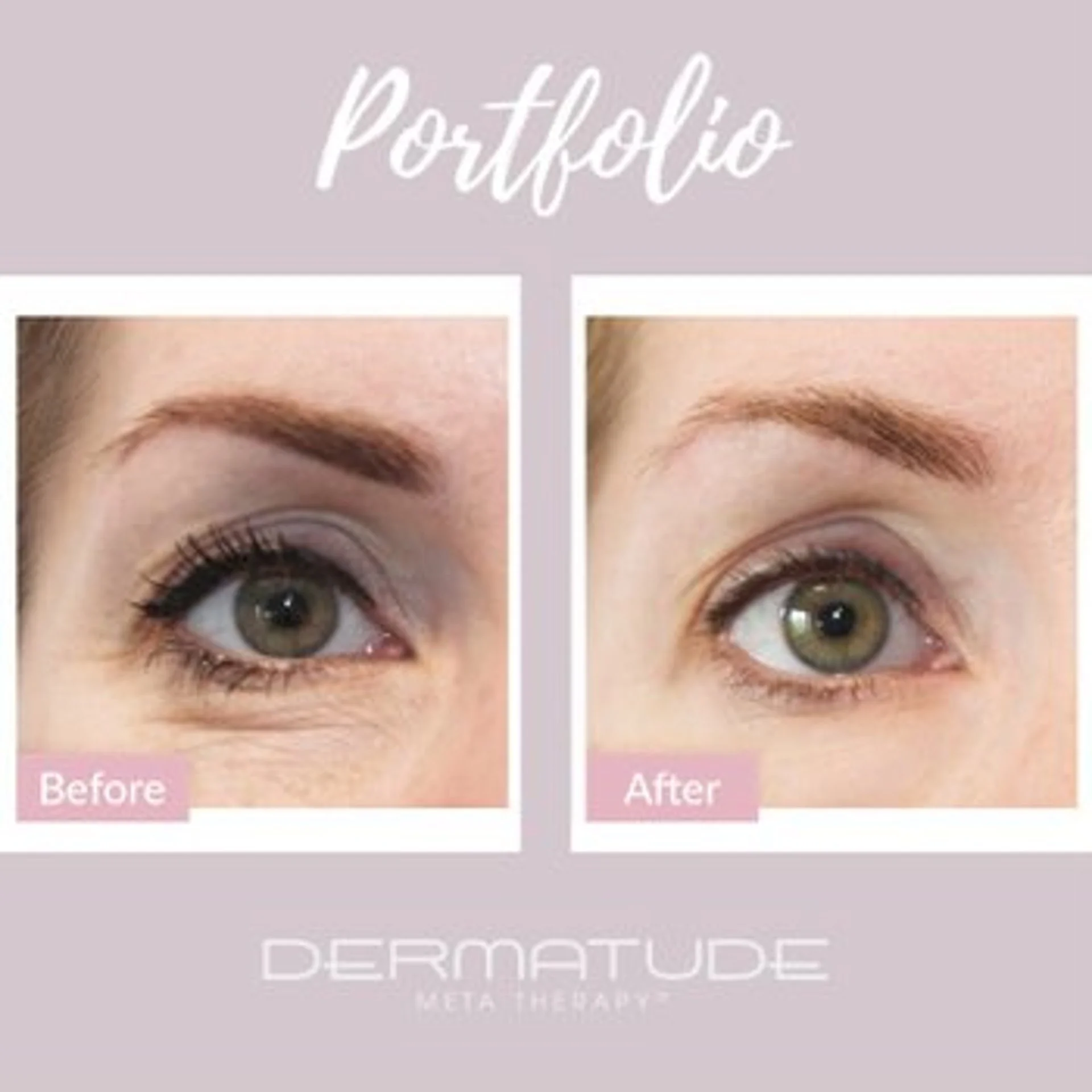 Vorher-Nachher Augenpartie Behandlung bei Lena Fuchs Kosmetikstudio